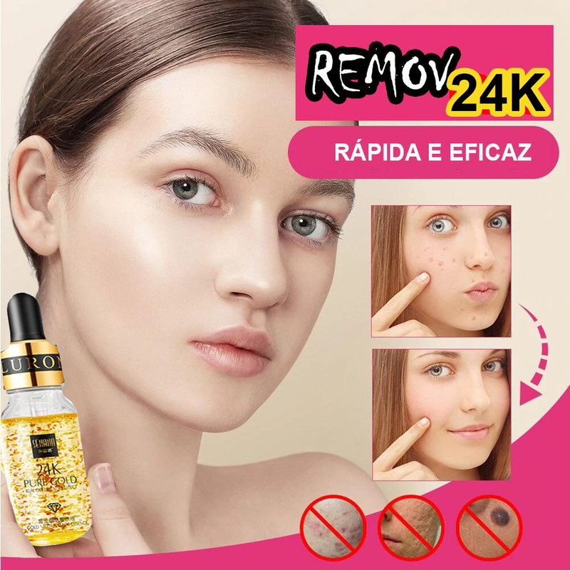 Remov 24K Gold - Choque Criativo